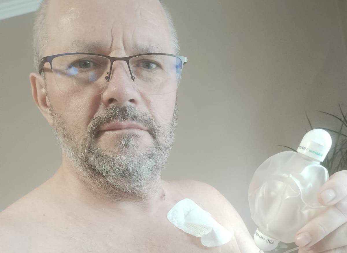 Biztató eredmények: túl van a 21. kemoterápiás kezelésen a nagyszalontai Gyulai Sándor