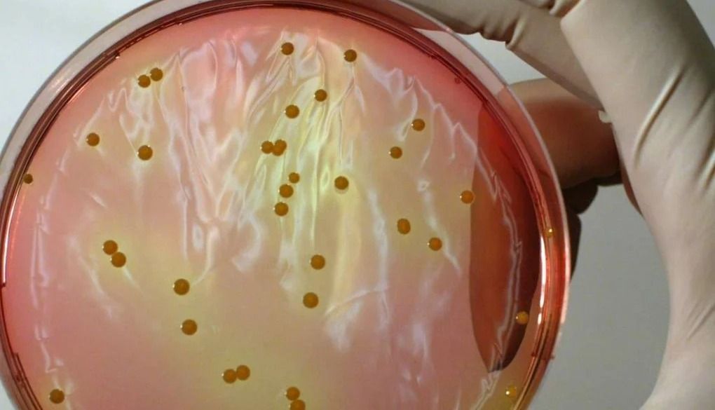 A szászrégeni házas emberek bálján felszolgált több étel is staphylococcusszal volt fertőzött