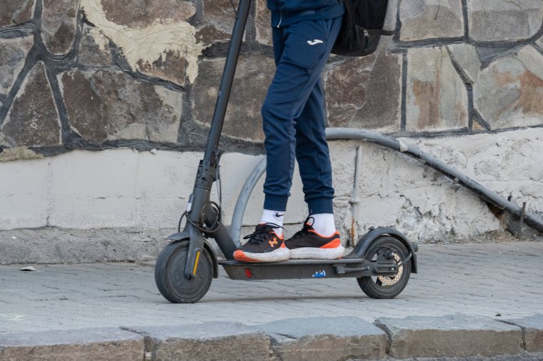 Újabb súlyos elektromos rolleres baleset: életmentő műtéten esett át egy tízéves kisfiú