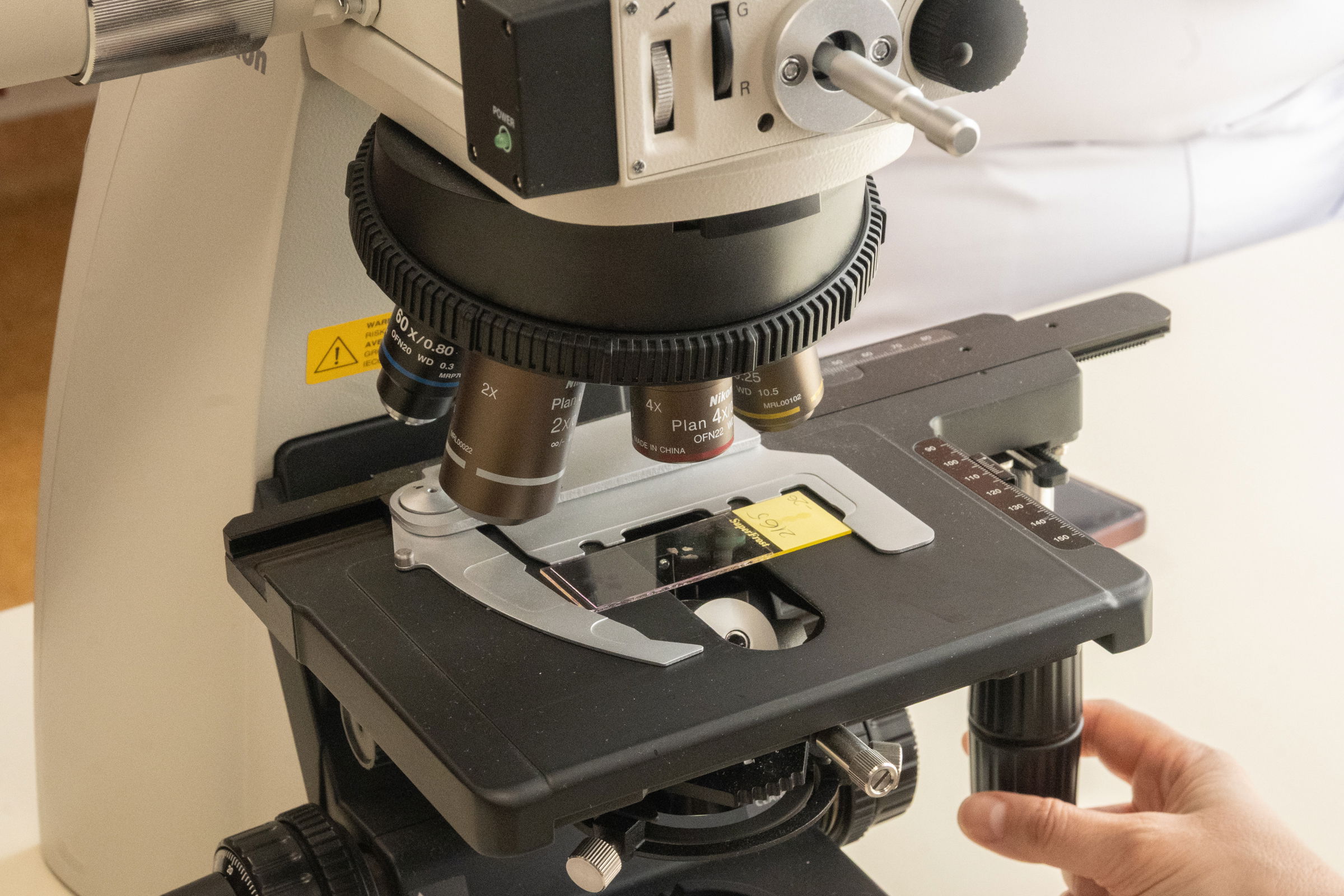 Hatfős család került kórházba botulizmus gyanújával házi készítésű húsáru fogyasztása után