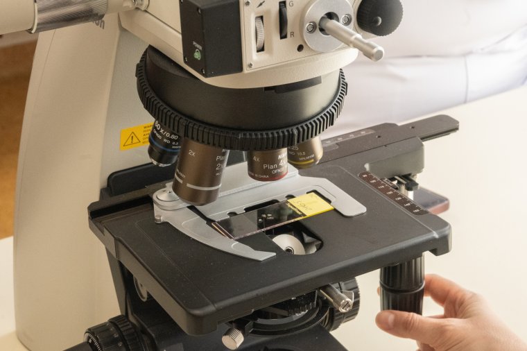 Hatfős család került kórházba botulizmus gyanújával házi készítésű húsáru fogyasztása után