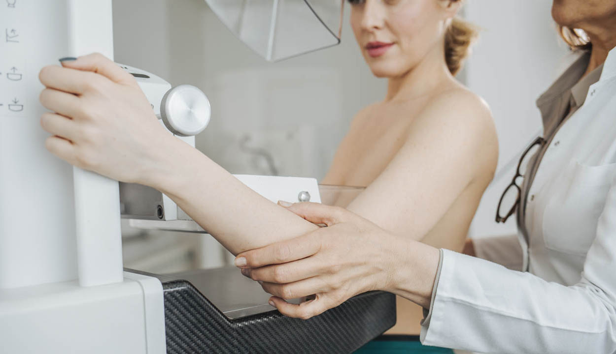 „A mellrák már nem egyenlő a reménytelenséggel”