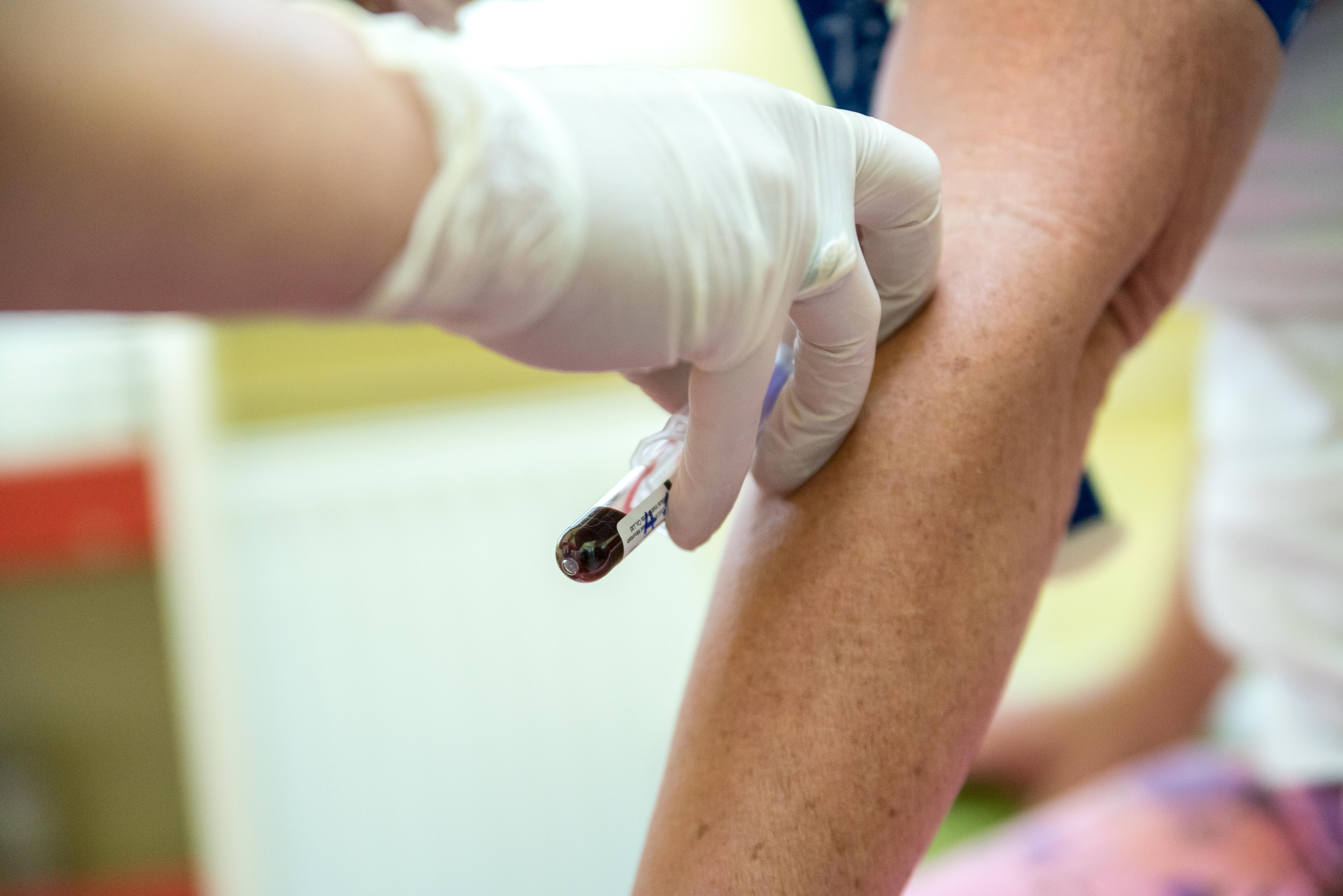 Terjed a nyugat-nílusi vírus Romániában, Bihar megyében is regisztráltak fertőzést